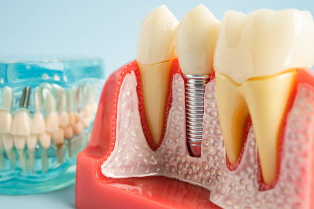 Best Dental Inlays and Onlays  in Prudenville, MI